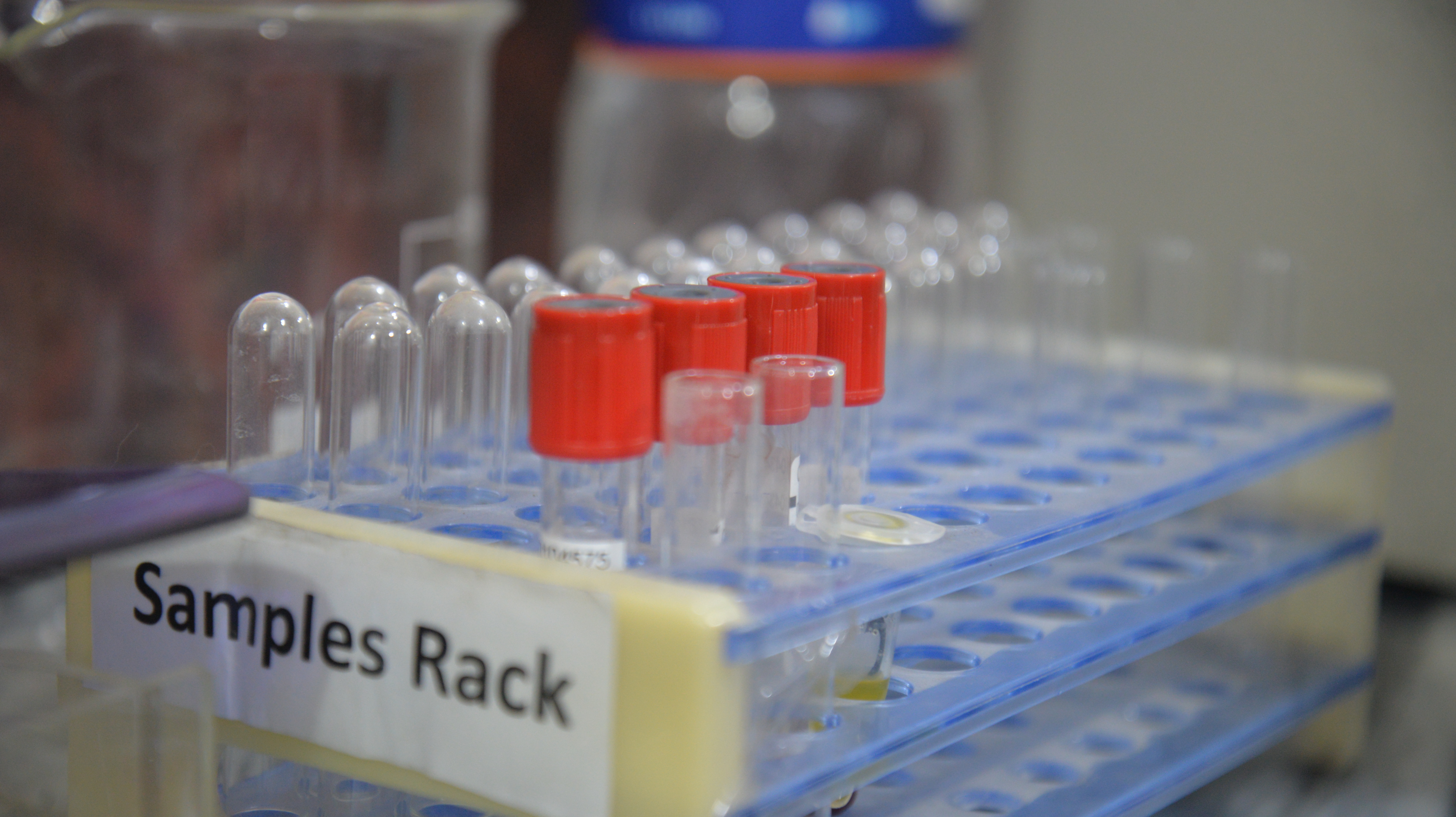MLT Lab 1